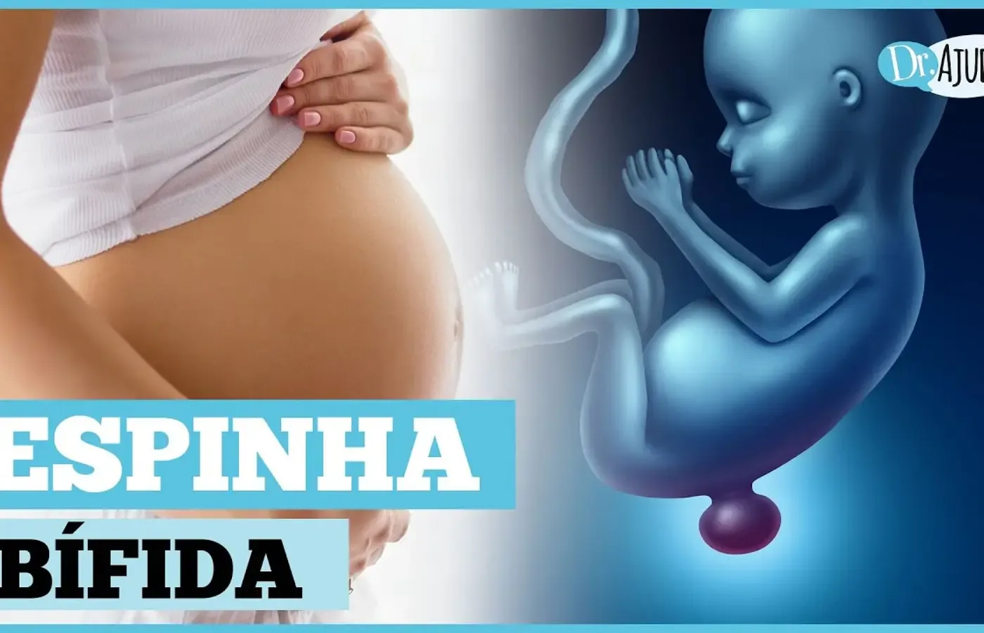O que é e como prevenir a mielomeningocele?