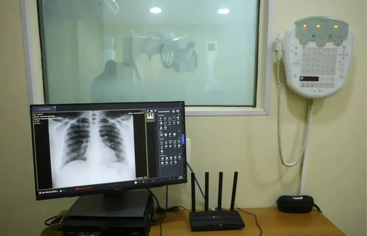 RS decreta emergência em saúde pública diante da alta de hospitalizações por doenças respiratórias